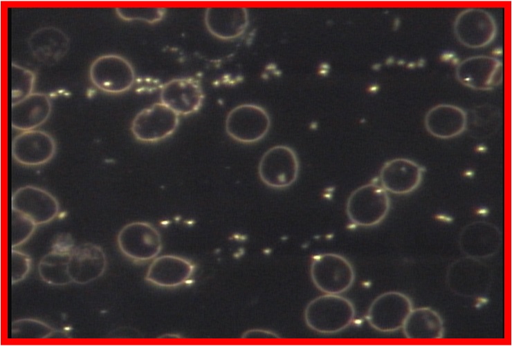 Blood cells after Auum Oil_5