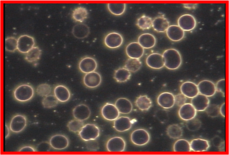 Blood cells before Auum Oil_2