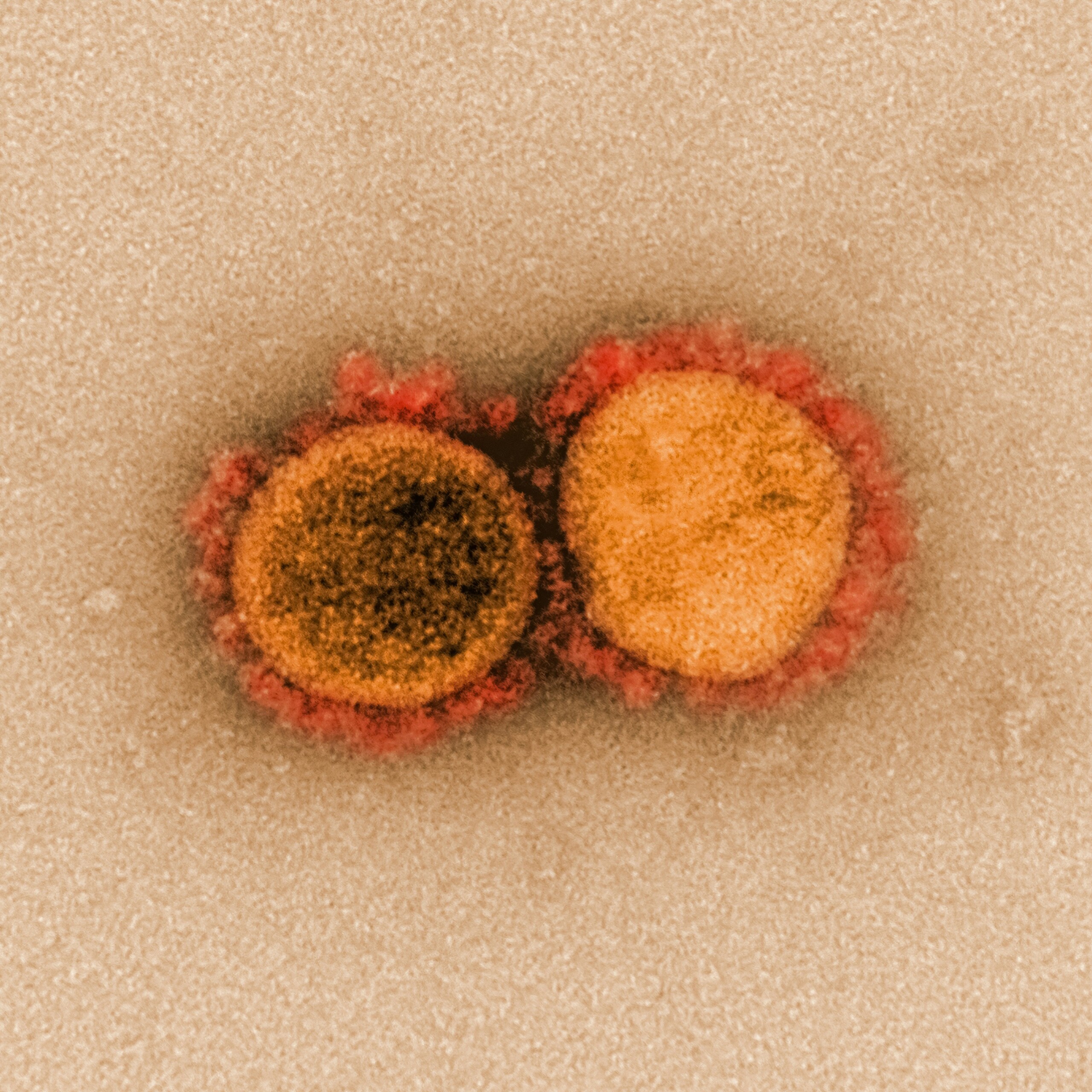 The Shingles virus