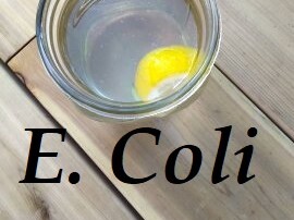 E Coli microbiome